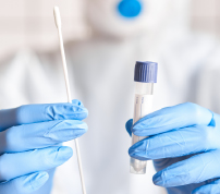 servizio tamponi rapidi in azienda